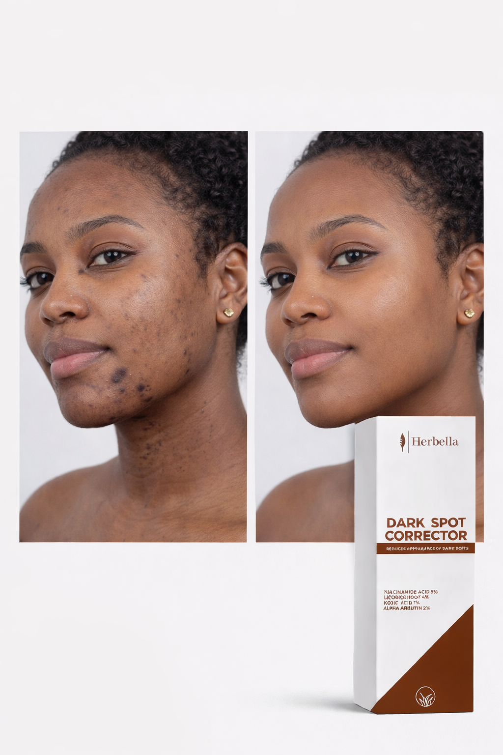 Dark Spots Corrector Serum